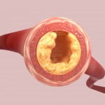 This magical juice can reduce high BP and high ldl cholesterol