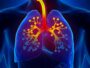 Allergy And Asthma Associates – Why You Need to Join This Allergy Asthma Associations