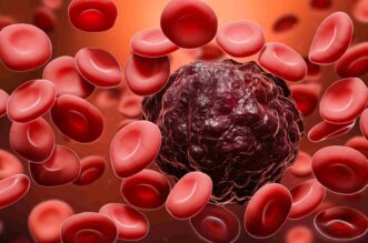 10 Causes for Blood Cancer That You Should Never Ignore 2