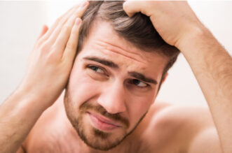 What to Expect When Experiencing Male Pattern Baldness 1